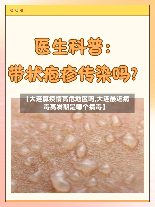 【大连算疫情高危地区吗,大连最近病毒高发期是哪个病毒】